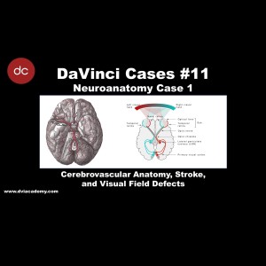 Cerebrovascular Anatomy, Stroke, and Visual Field Defects [#DaVinciCases Neuroanatomy 1 - Cerebrovascular 1]