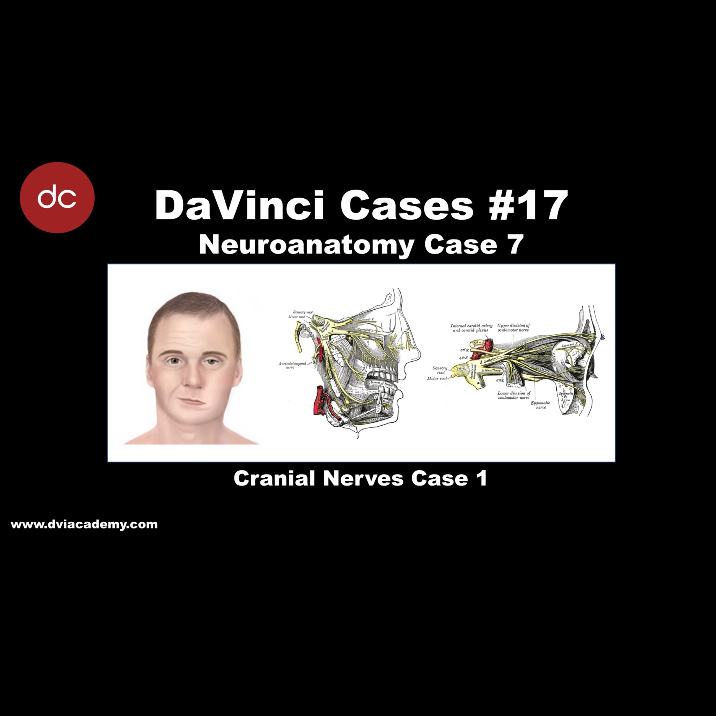 #DaVinciCases