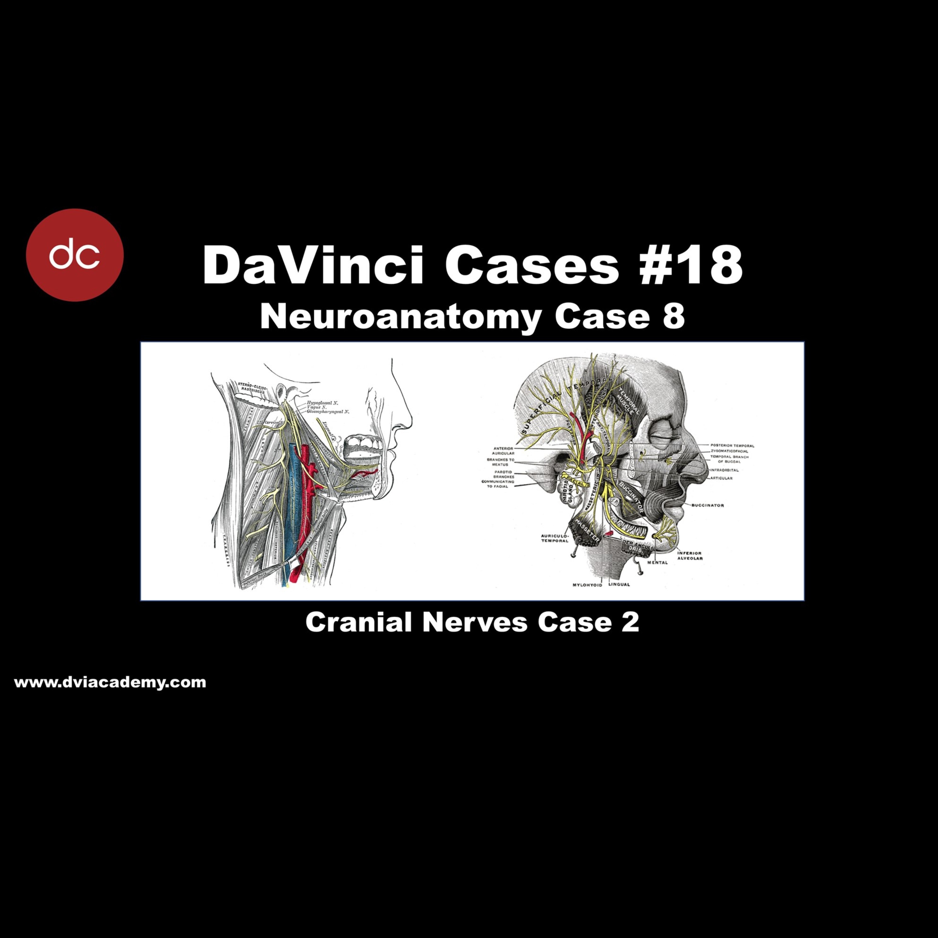 #DaVinciCases