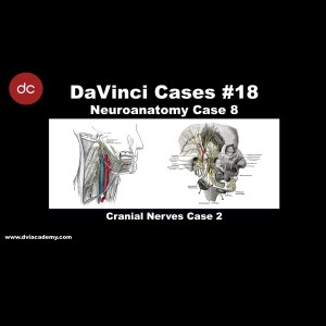 Cranial Nerves Lesions 2 [#DaVinciCases Neuroanatomy 8 - Cranial Nerves 2]