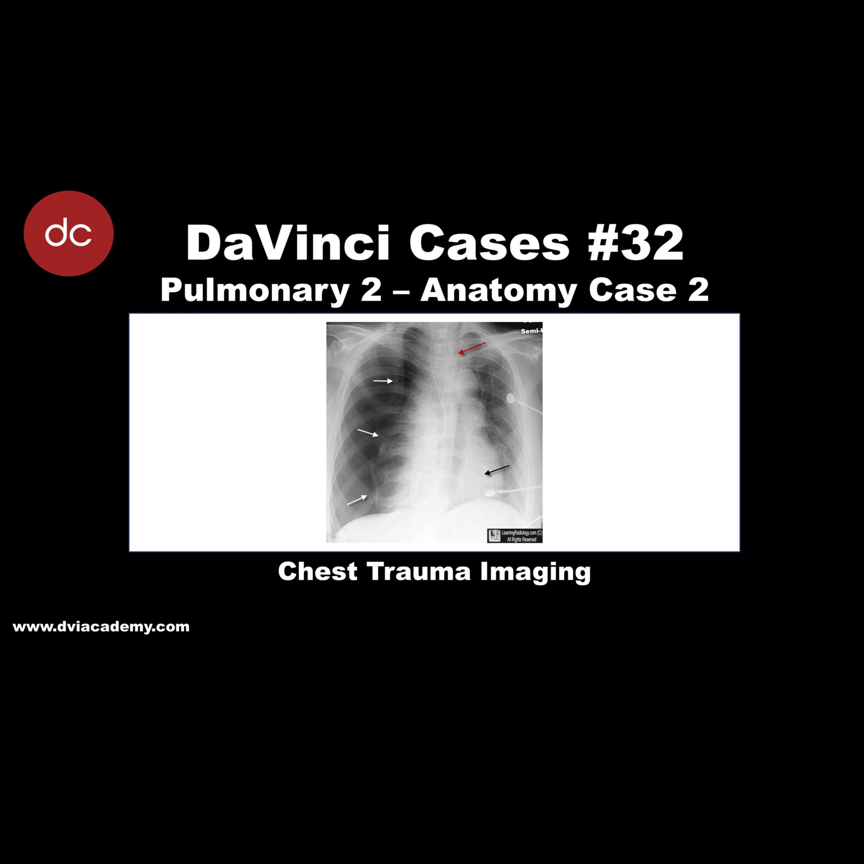 #DaVinciCases