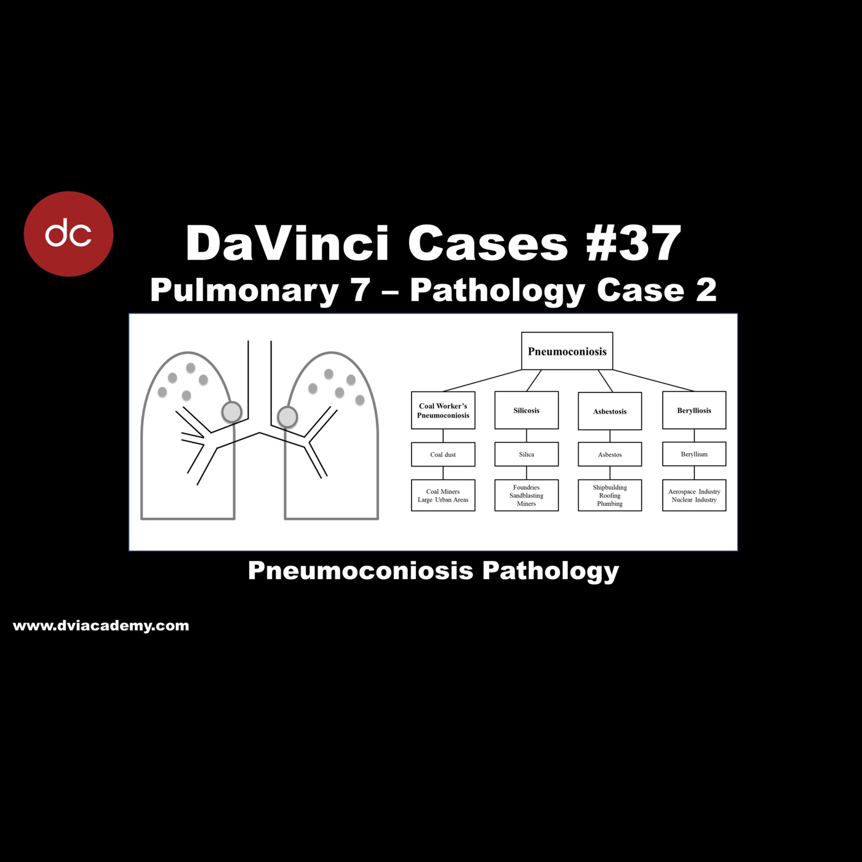 cases of berylliosis