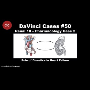 Role of Diuretics in Heart Failure [#DaVinciCases Renal 10 - Pharmacology Case 2]