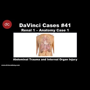 Abdominal Trauma & Internal Organ Injury [#DaVinciCases Renal 1 - Anatomy Case 1]
