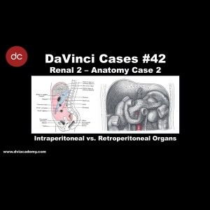 Intraperitoneal vs Retroperitoneal Organs [#DaVinciCases Renal 2 - Anatomy Case 2]