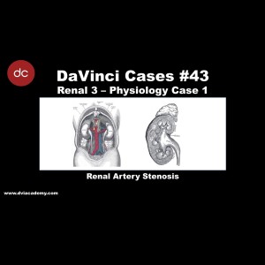 Renal Artery Stenosis [#DaVinciCases Renal 3 - Physiology Case 1]