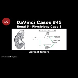 Adrenal Tumors [#DaVinciCases Renal 5 - Physiology Case 3]