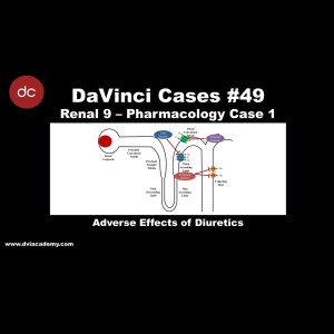 Adverse Effects of Diuretics [#DaVinciCases Renal 9 - Pharmacology Case 1]