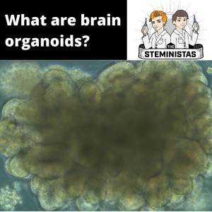 What are Brain Organoids?