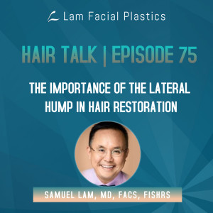Dallas Hair Transplant Podcast: The Importance of the Lateral Hump in Hair Restoration
