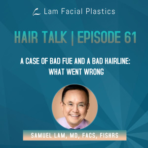 Dallas Hair Transplant Podcast: A Case of Bad FUE and Bad Hairline - What Went Wrong?