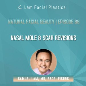 Dallas Cosmetic Surgery Podcast: Nasal Mole & Scar Revisions