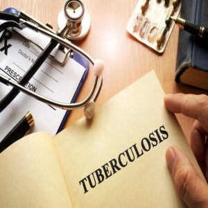 Tuberculosis in Primary Care