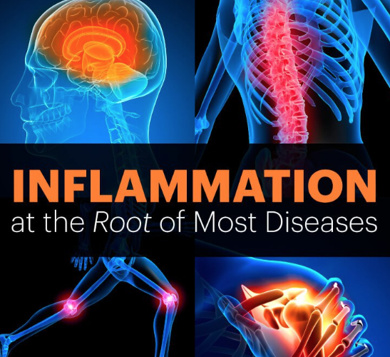 Inflammation: What is it and how does it affect our health