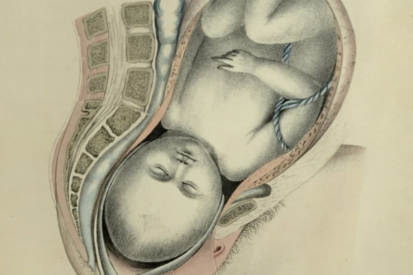 Racial Hygiene & Creating Healthy Babies