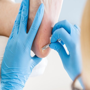Follow these Tips to Hire a Suitable Podiatrist