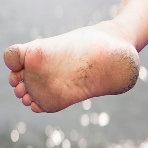 Key Attributes to Look for in a Podiatrist