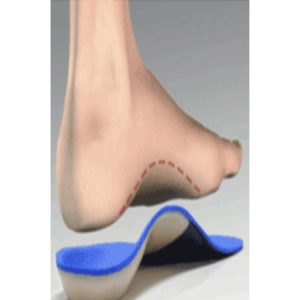 What are the Various Types of Orthotic Devices and Their Uses?