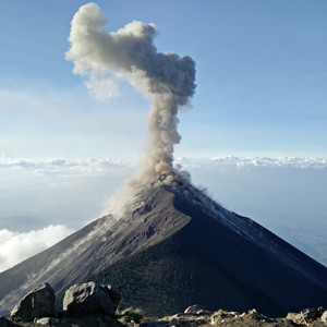Eruptions: Relationship Goals, Blackheads & Sebaceous Cysts