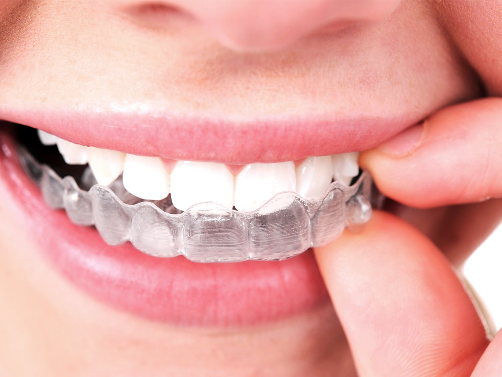 North Las Vegas Orthodontist