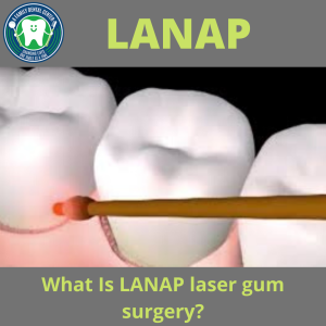 LANAP: What Is LANAP?