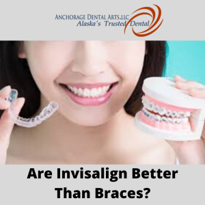 Invisalign: What Is Clear Aligners?