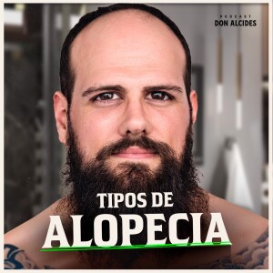 Conheça os tipos de alopecia masculina, as causas e como tratar.