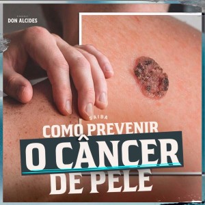 Saiba como prevenir o câncer de pele.