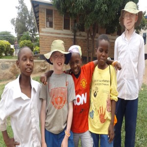 #125: Albinism in East Africa
