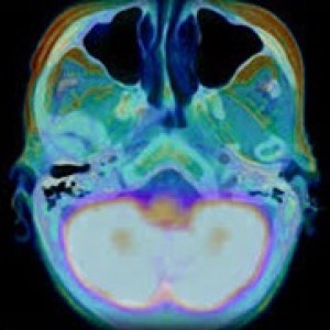 Ep 23: Your Brain on Stress