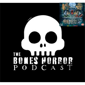 Episode 49 An American Werewolf in London