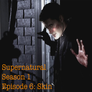 Supernatural S01 x E06 “Skin”