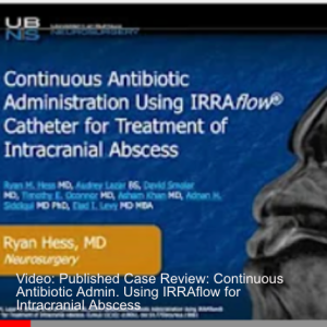 Video: Published Case Review: Continuous Antibiotic Admin. Using IRRAflow for Intracranial Abscess