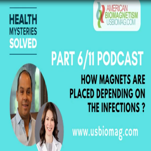 How Magnets Are Placed Depending On Infections? | [Podcast Part 6/11]
