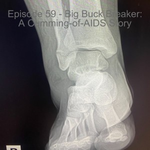 Episode 59 - Big Buck Breaker: A Cumming-of-AIDS Story