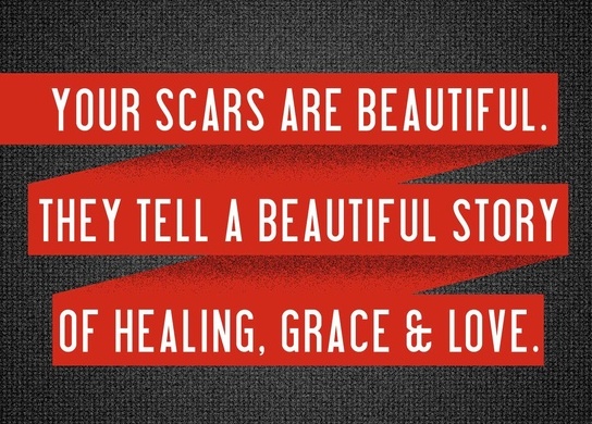 Your wounds and scars are beautiful to him