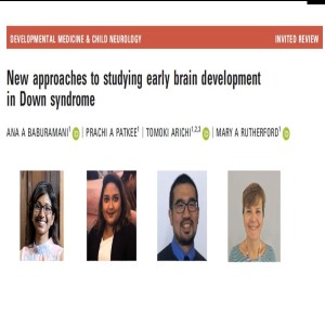 Down Syndrome: New Approaches to Studying Early Brain Development | Mary Rutherford | DMCN