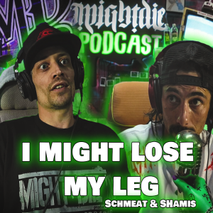 Schmeat & Shamis - I Might Lose My Leg