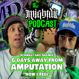 Schmeat - 6 Days away from Amputation "How I feel"