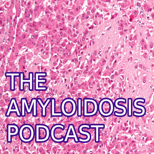 Amyloidosis Loss During Covid-19