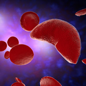 The Need for Safe and Reliable Blood Donations for the Sickle Cell Disease Population