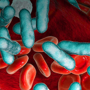 Understanding sepsis, its detection and treatment strategies