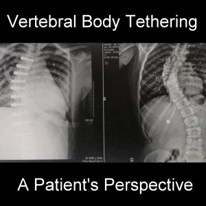 Patient Perspective with Zaylei on Vertebral Body Tethering (VBT)