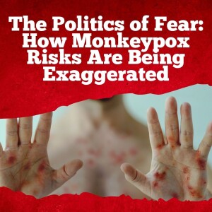 Monkeypox fearmongering is irresponsible