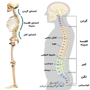 علل مشكلات ديسك كمر و راه كارهاي درمان