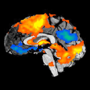 Fitness and the cortical response to autonomic challenge