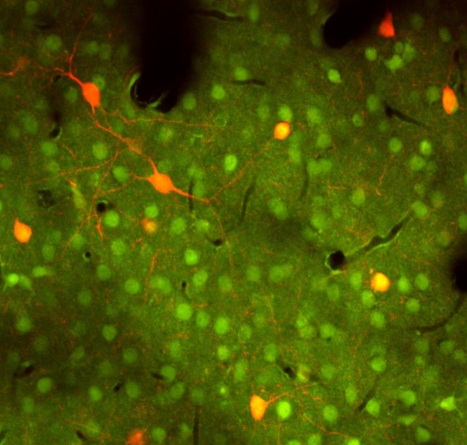 Manifestation of Acoustic Trauma in the Auditory Cortex