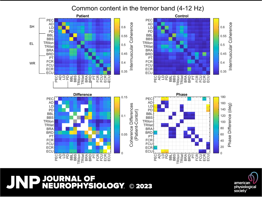 Journal of Neurophysiology