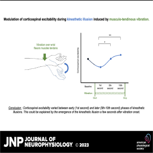 JNP Micro Podcasts: Modulation of corticospinal excitability during vibration