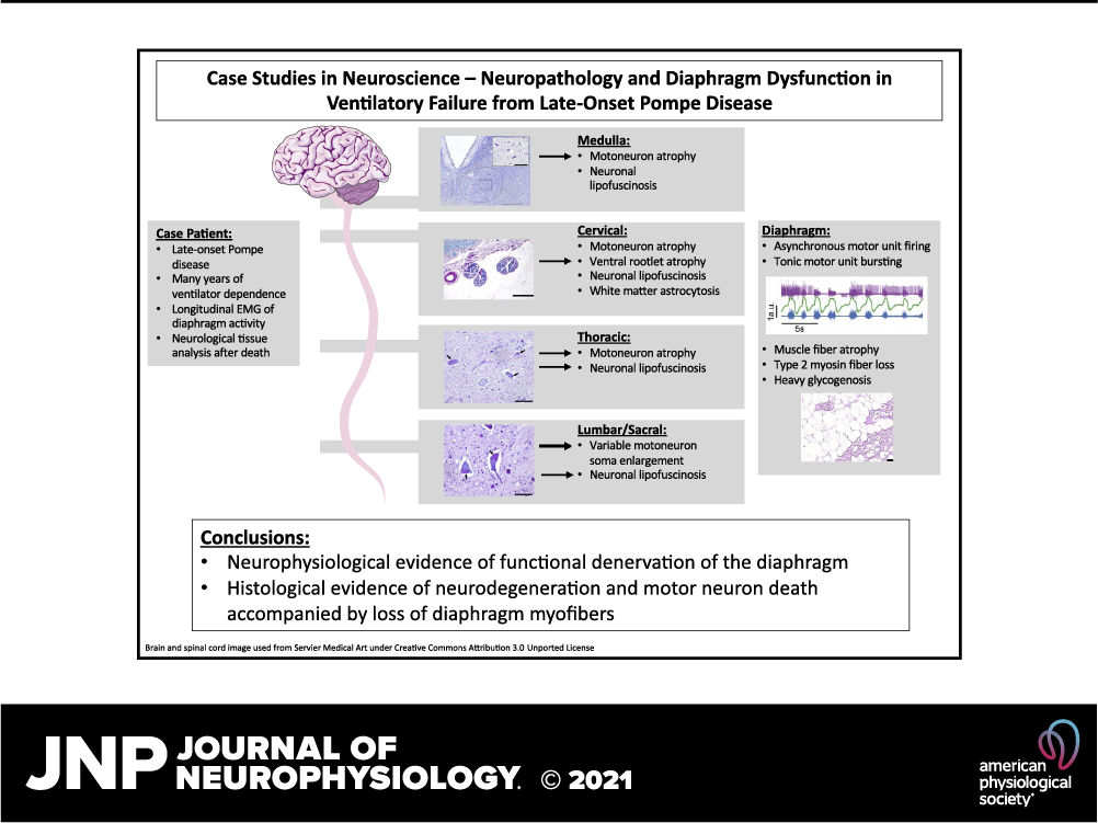 Journal of Neurophysiology